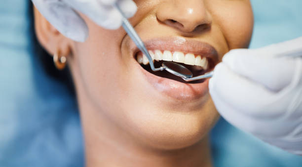 Best Emergency Root Canal Treatment in Boston Heights, OH